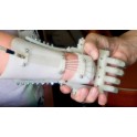 Prothese de main imprime en 3D