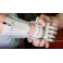 Prothese de main imprime en 3D